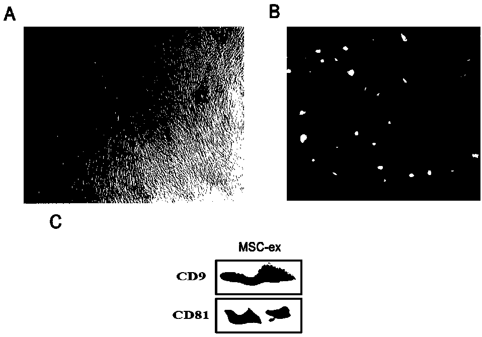 Separation and purification method of human umbilical cord mesenchymal stem cell exosome and application of human umbilical cord mesenchymal stem cell exosome