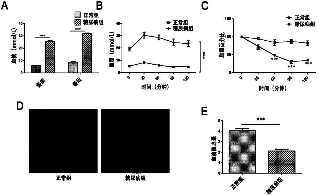 Separation and purification method of human umbilical cord mesenchymal stem cell exosome and application of human umbilical cord mesenchymal stem cell exosome