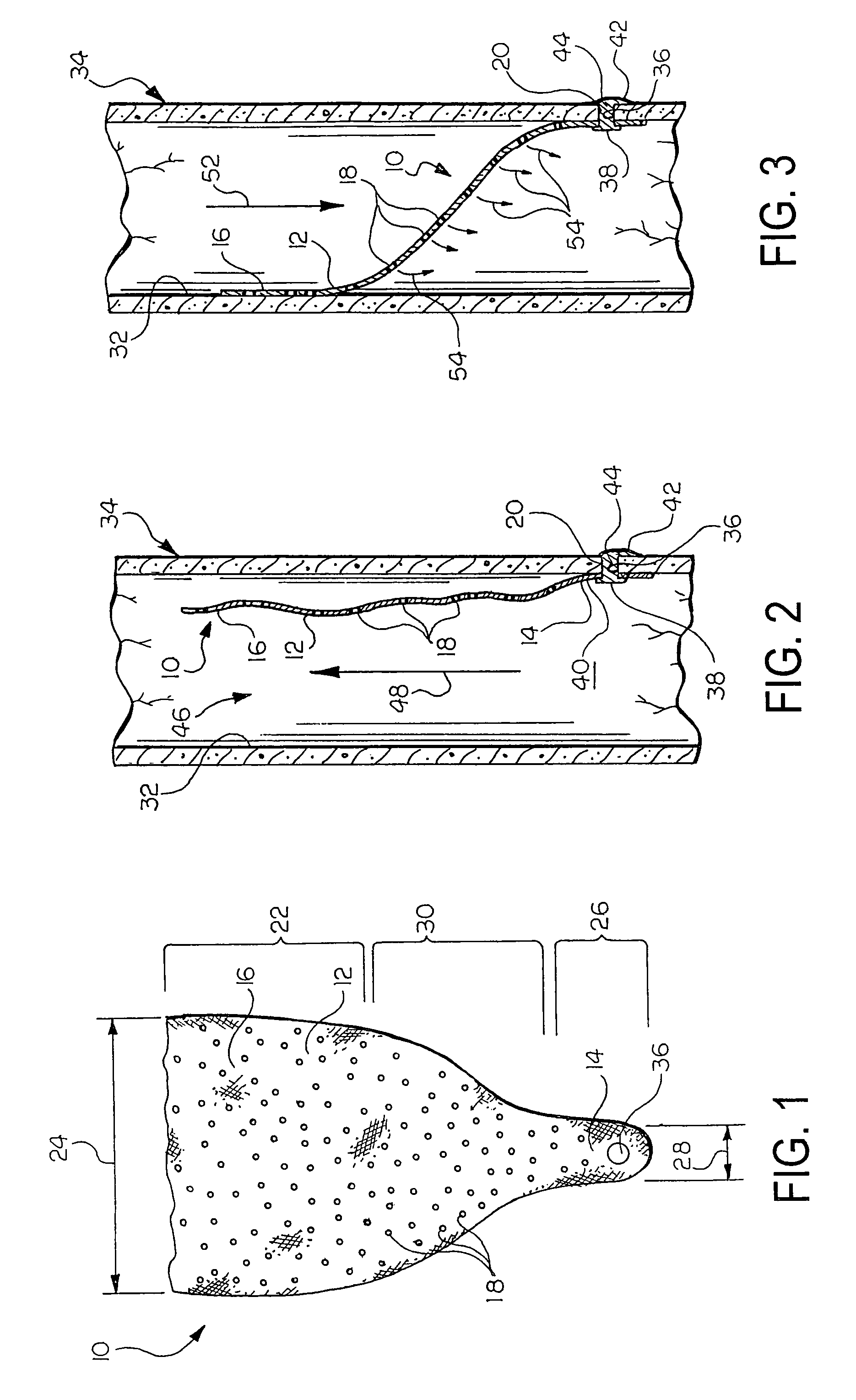 Prosthetic valve with pores