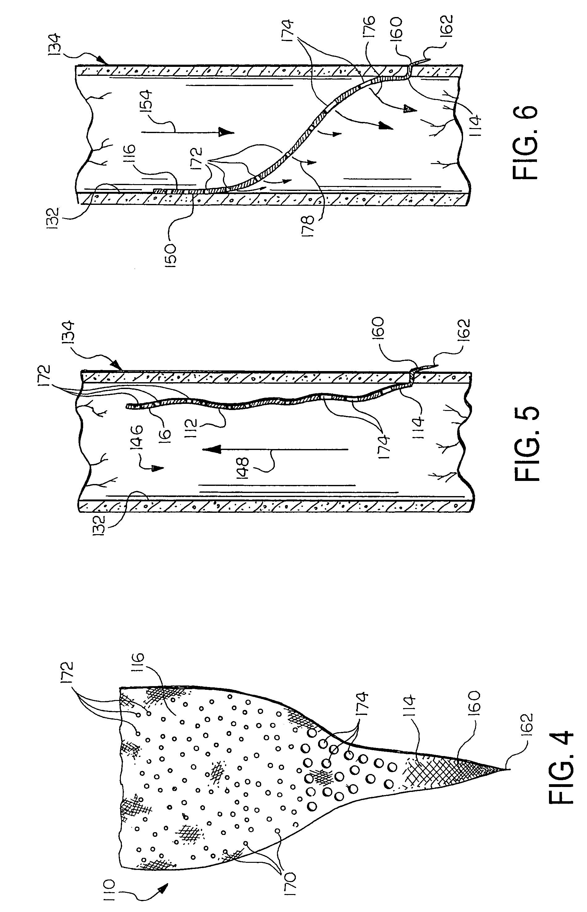 Prosthetic valve with pores