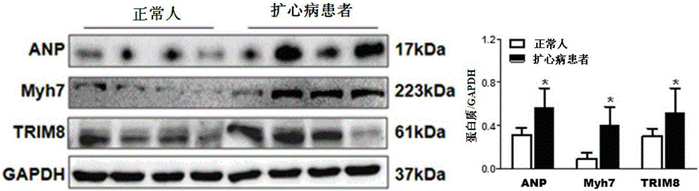 Function and application of TRIM8 (tripartite motif 8) inhibitor in inhibition of myocardial hypertrophy