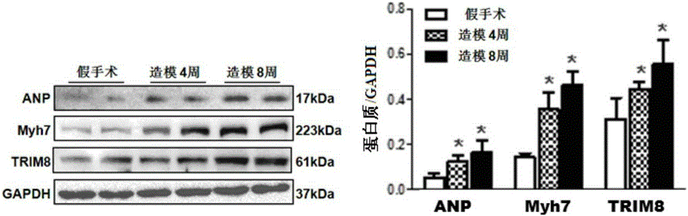 Function and application of TRIM8 (tripartite motif 8) inhibitor in inhibition of myocardial hypertrophy