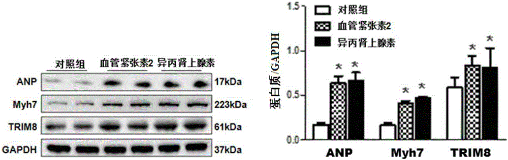 Function and application of TRIM8 (tripartite motif 8) inhibitor in inhibition of myocardial hypertrophy