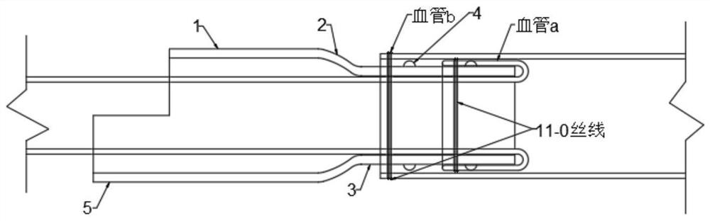 Blood vessel and lymphatic vessel anastomosis sleeve device for microsurgery