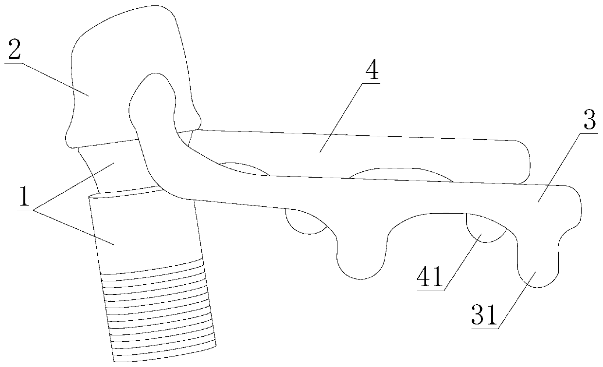 Mandibular posterior tooth lowering device