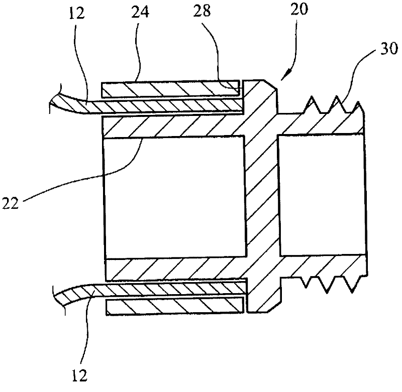 Support structure implant for a bone cavity