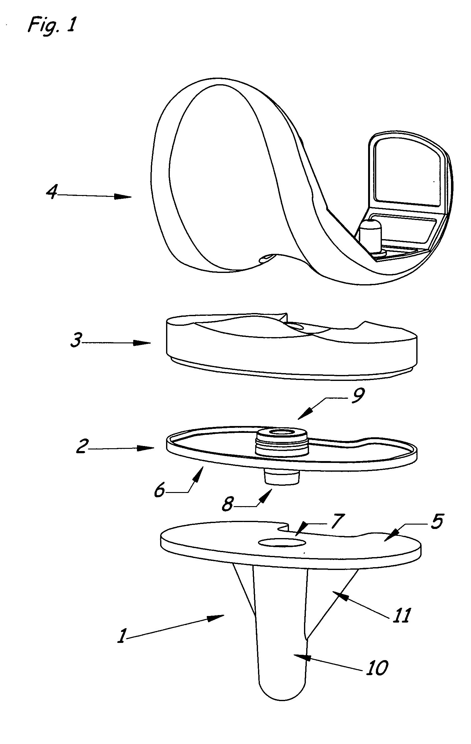 Modular knee prosthesis