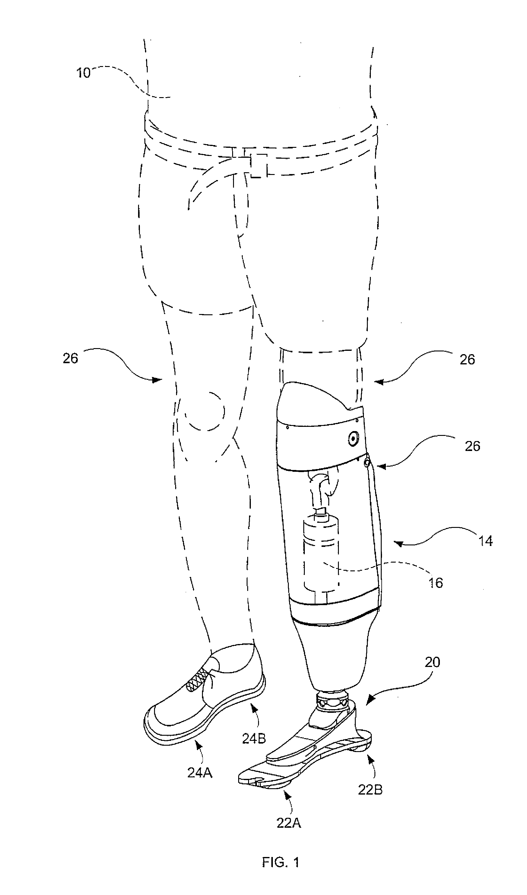 Instrumented prosthetic foot