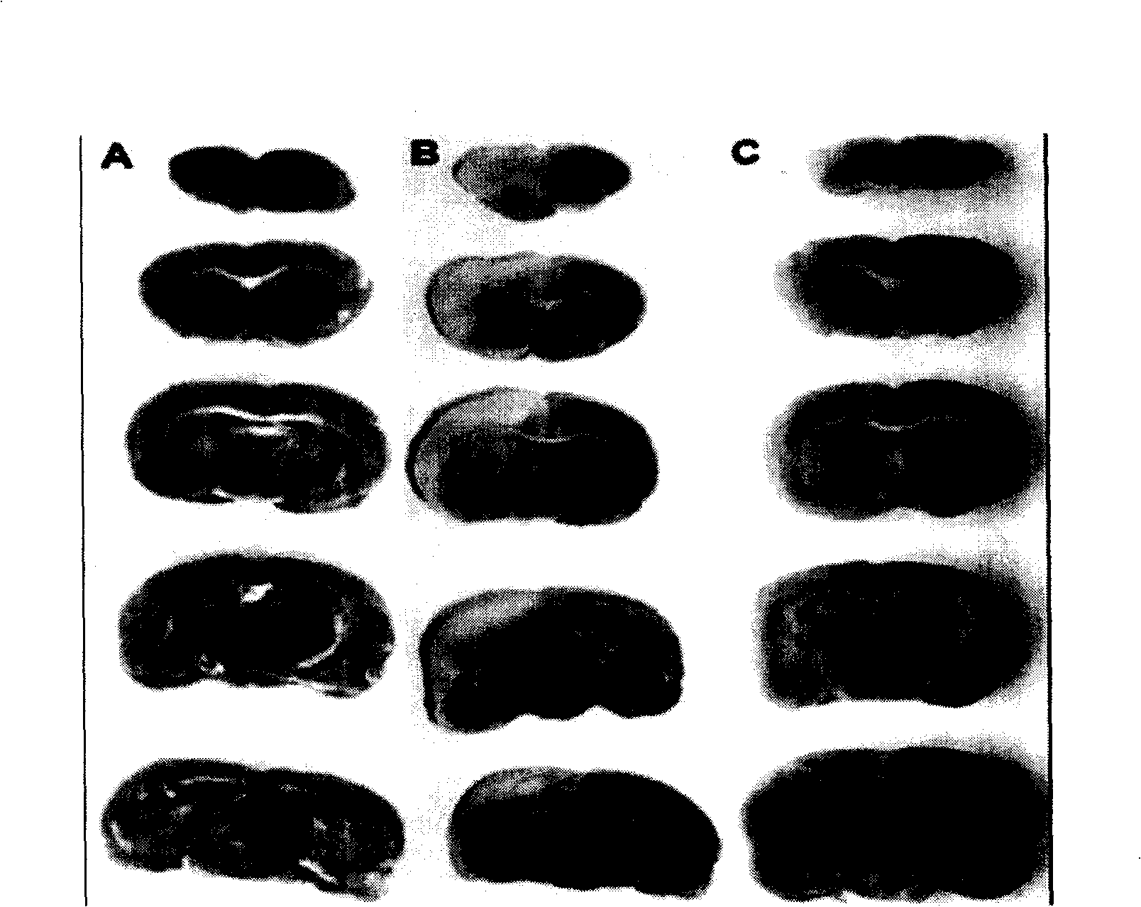 Hydrogenous injection having function for treating ischemia-reperfusion injury