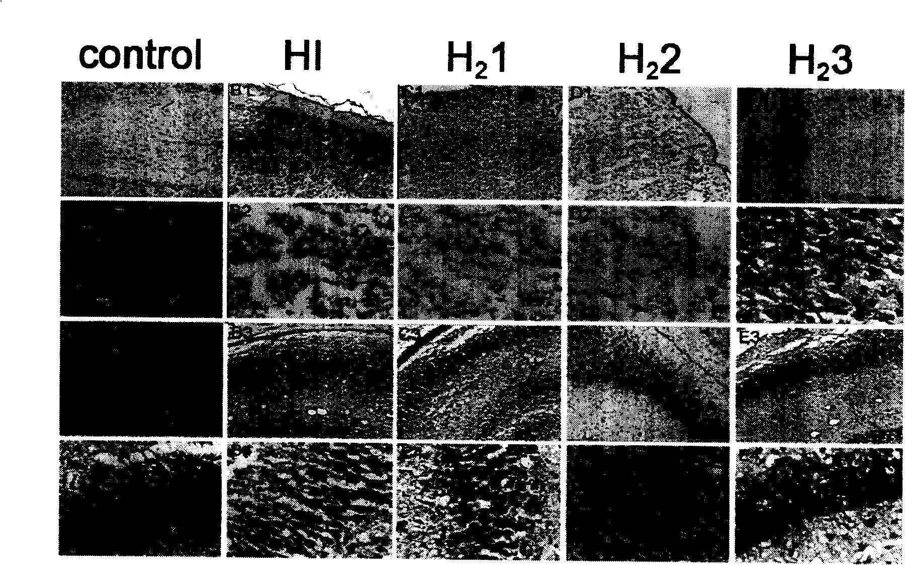 Hydrogenous injection having function for treating ischemia-reperfusion injury