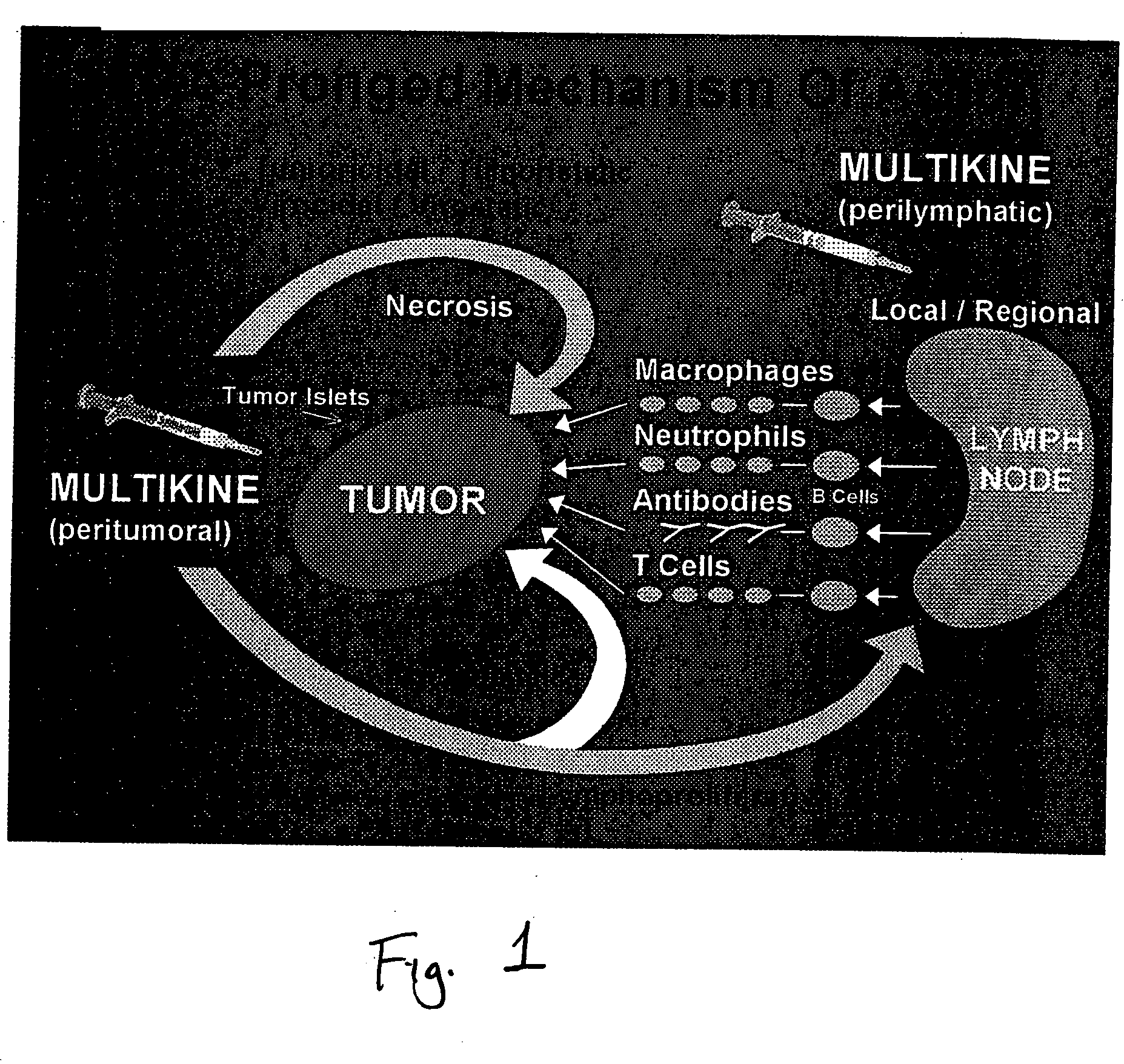 Method of pre-sensitizing cancer prior to treament with radiation and/or chemotherapy and a novel cytokine mixture