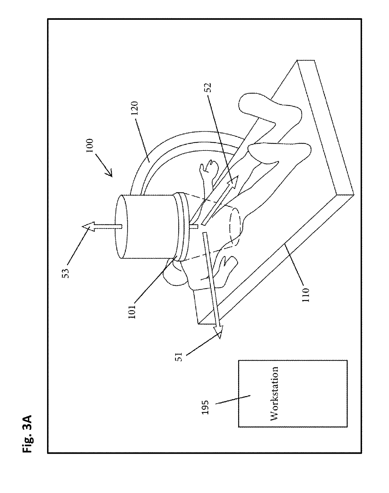 Fluoroscopy-Based Measurement and Processing System and Method