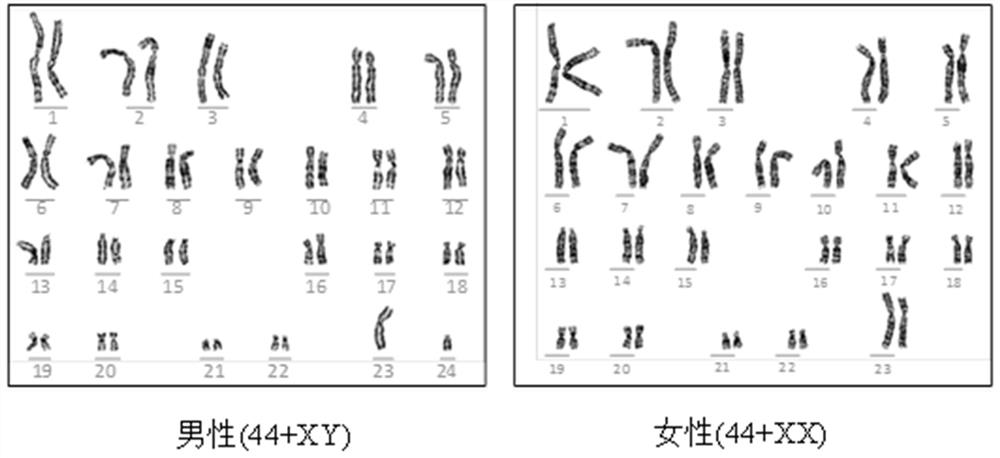 Chromosome karyotype analysis system