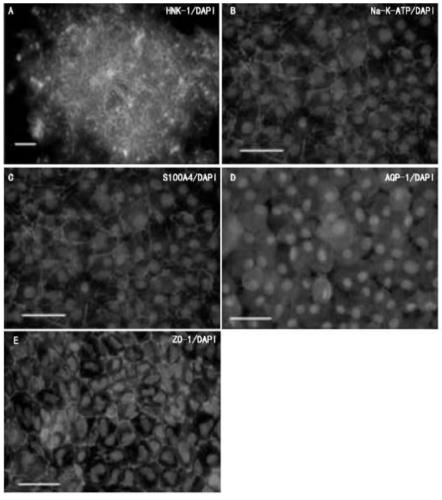 Method for obtaining corneal endothelial cells