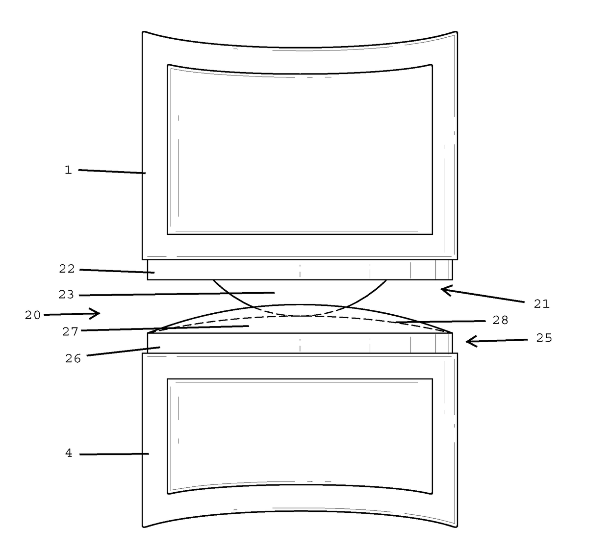 Intervertebral disc implant and method for restoring function to a damaged functional spinal unit