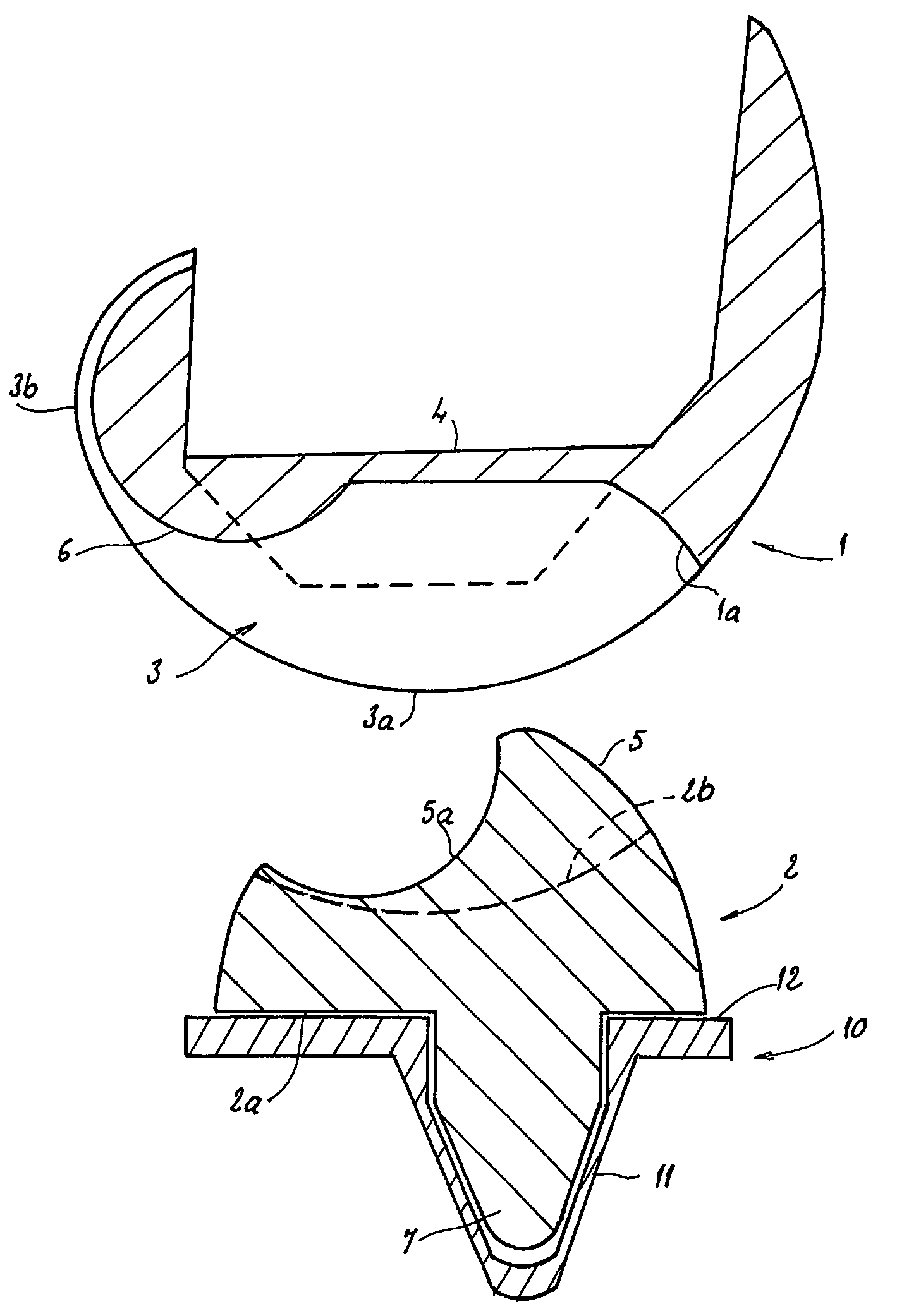 Complete knee prosthesis