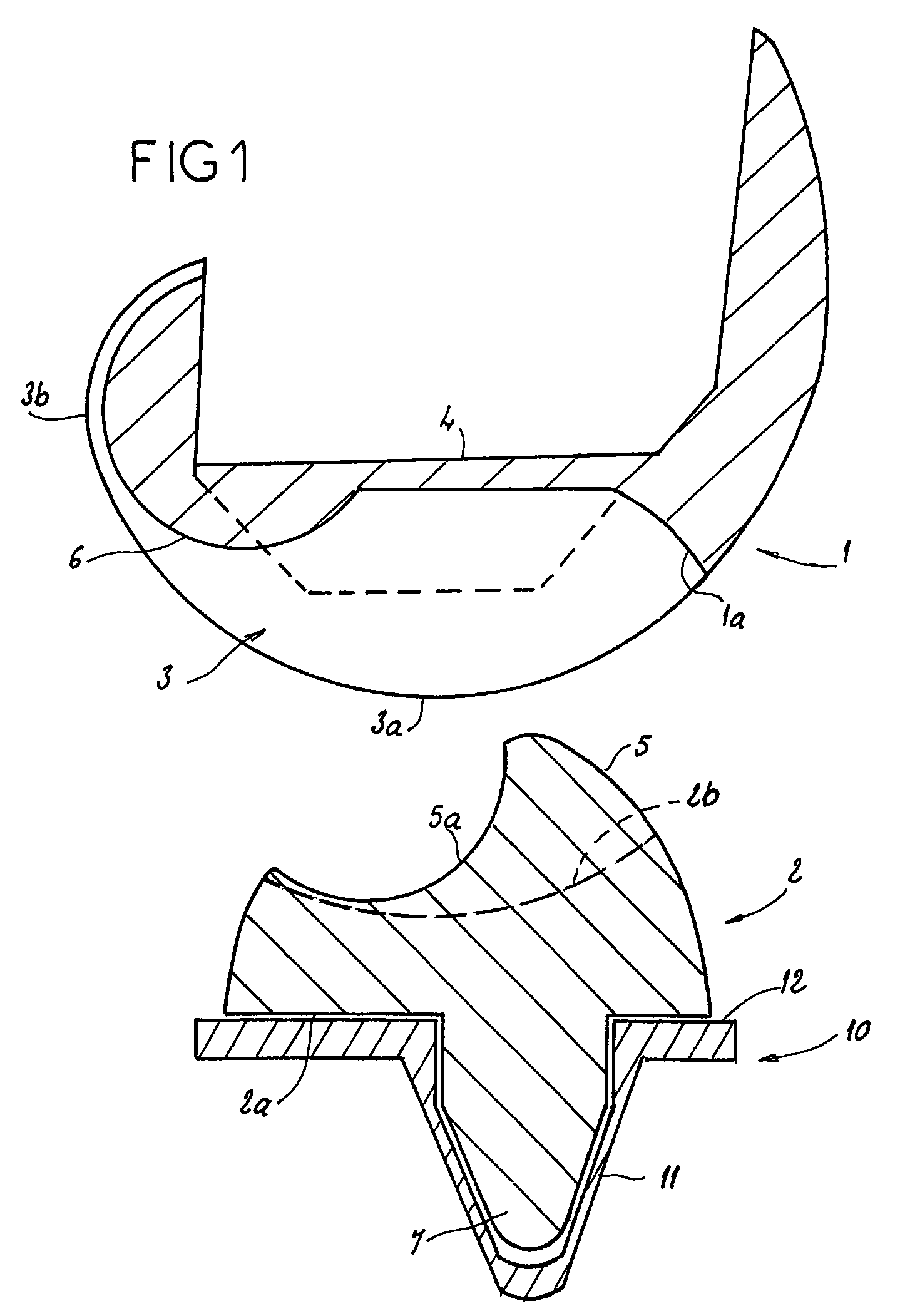 Complete knee prosthesis