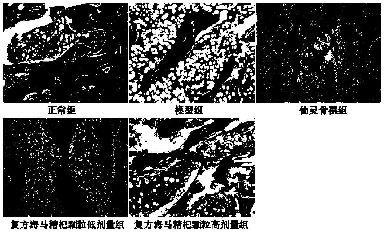 Medical composition for preventing and/or treating osteoporosis and preparation method and application of medical composition