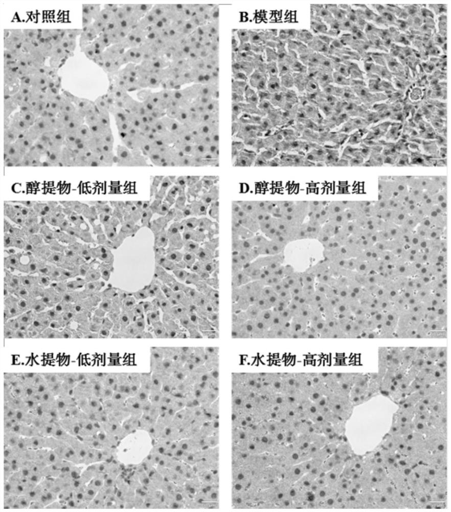 Purpose of Rhus chinensis Mill. fruit or extract thereof in acceleration of fatty acid metabolism, and product for accelerating fatty acid metabolism