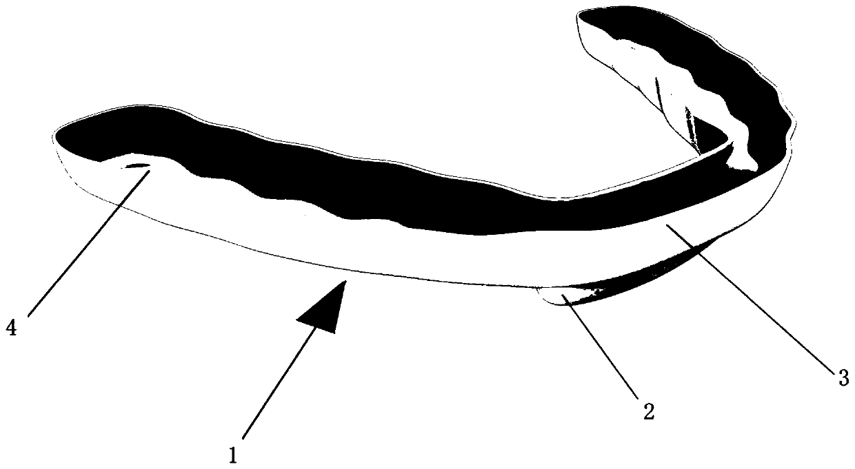 Manufacturing method of repositioning biteplate for treating temporal-mandibular joint disc recoverable forward displacement and repositioning biteplate