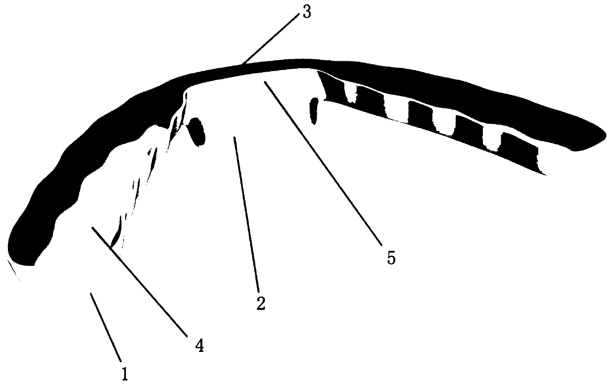 Manufacturing method of repositioning biteplate for treating temporal-mandibular joint disc recoverable forward displacement and repositioning biteplate