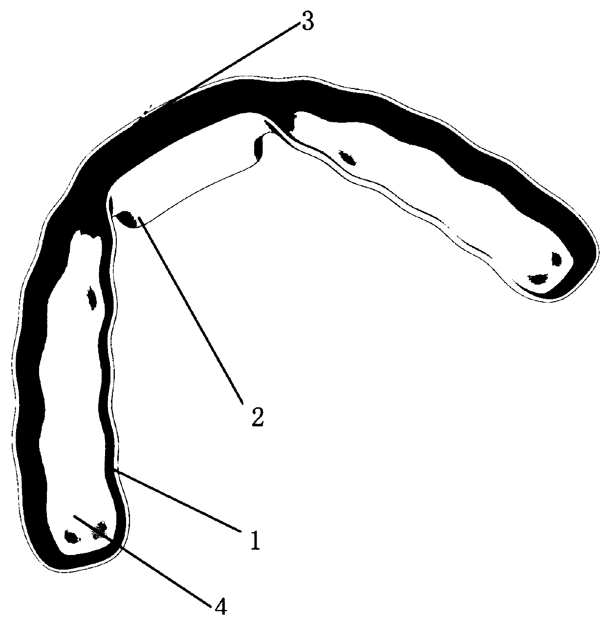 Manufacturing method of repositioning biteplate for treating temporal-mandibular joint disc recoverable forward displacement and repositioning biteplate