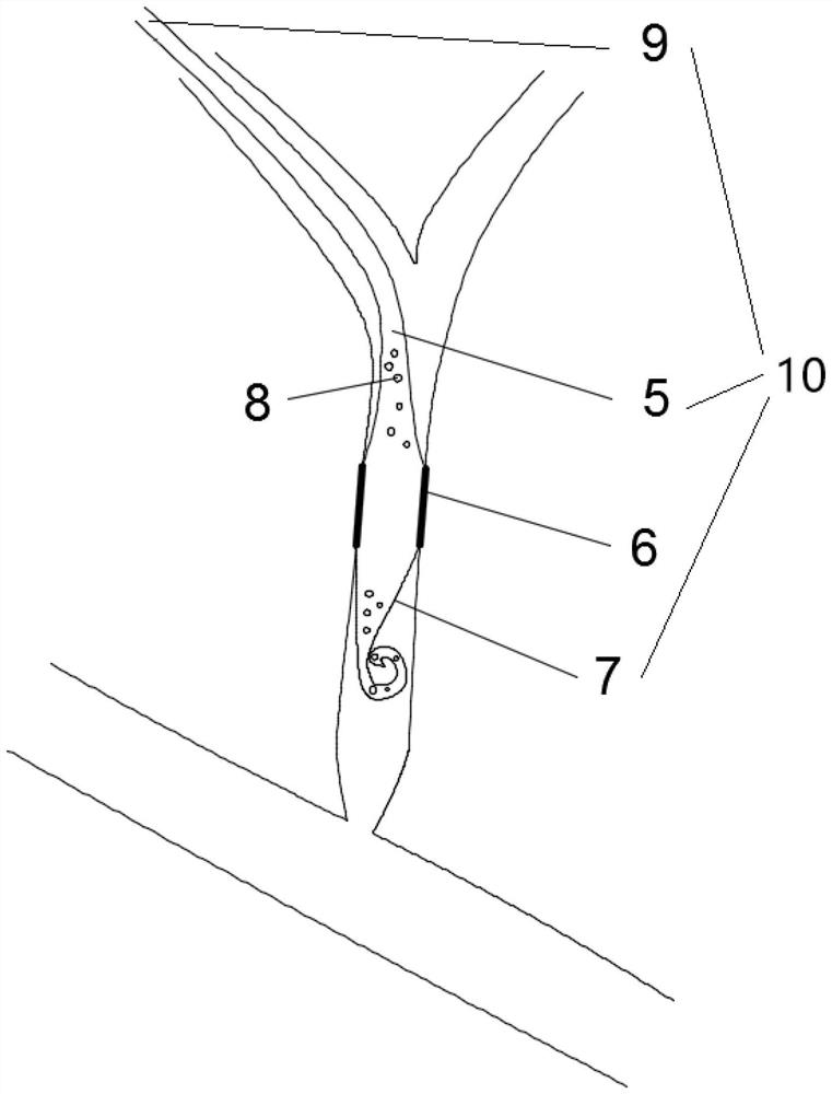 Recyclable biliary tract drainage tube coated stent