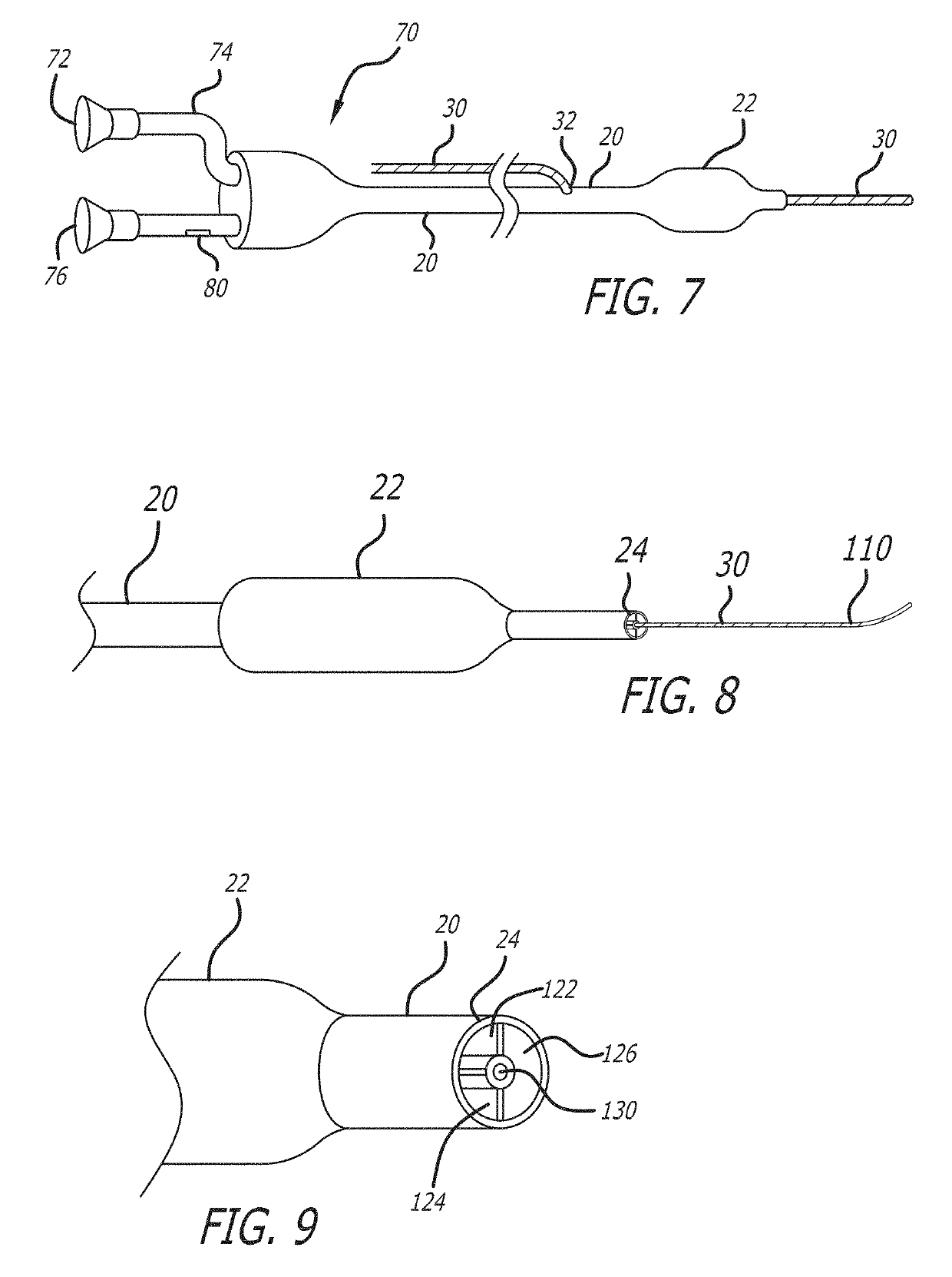 System and methods for treating MVO