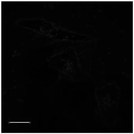 Cell membrane carbonic anhydrase IX fluorescent probe with high brightness and high stability