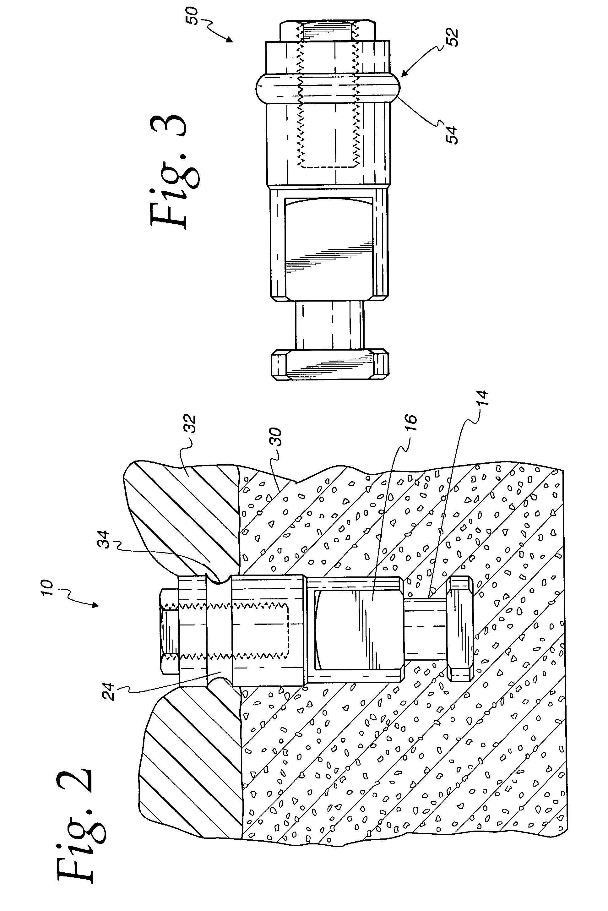 Dental implant analog having retention groove for soft tissue modeling