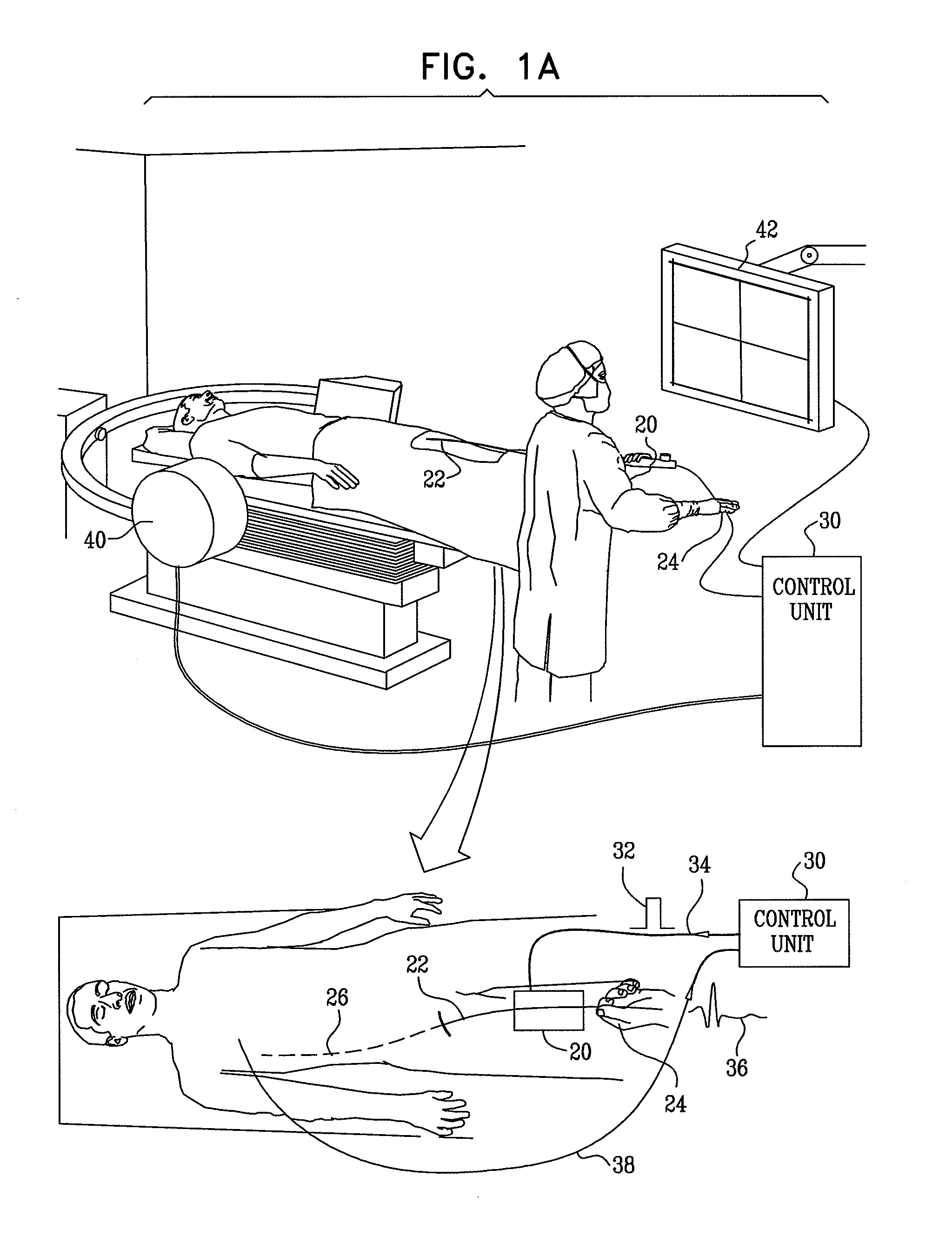 Stepwise advancement of a medical tool