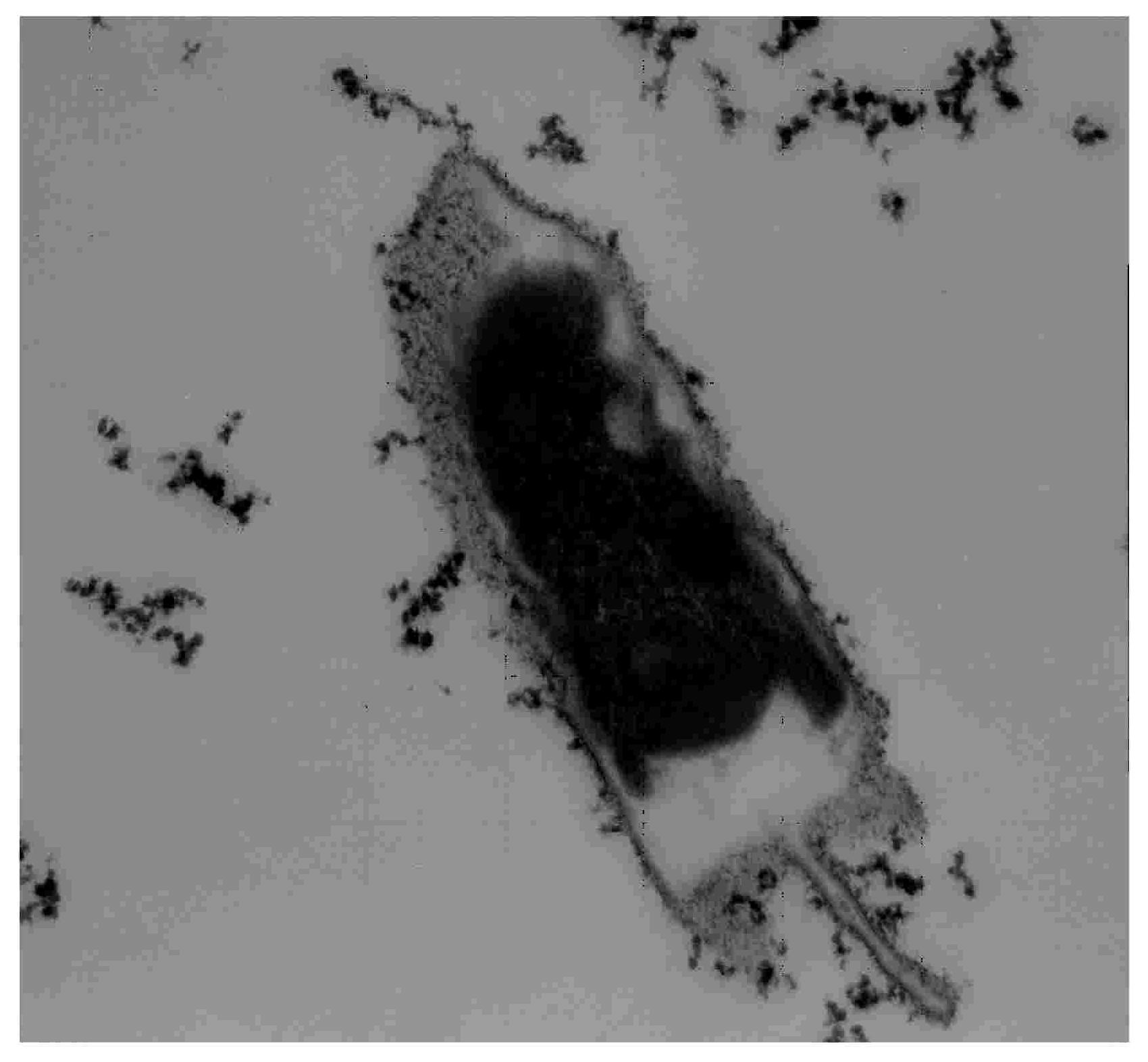 Application of Chinese medicine composition in preparation of medicament for treating overhigh level of urine cell factor or receptor thereof and Escherichia coli infection