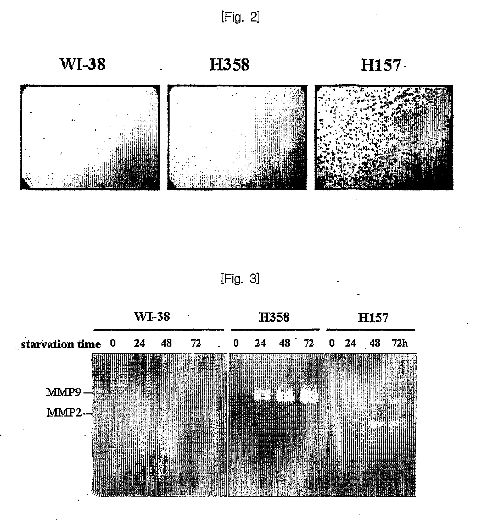 Novel use of ubiquitin c-terminal hydrolase-l1