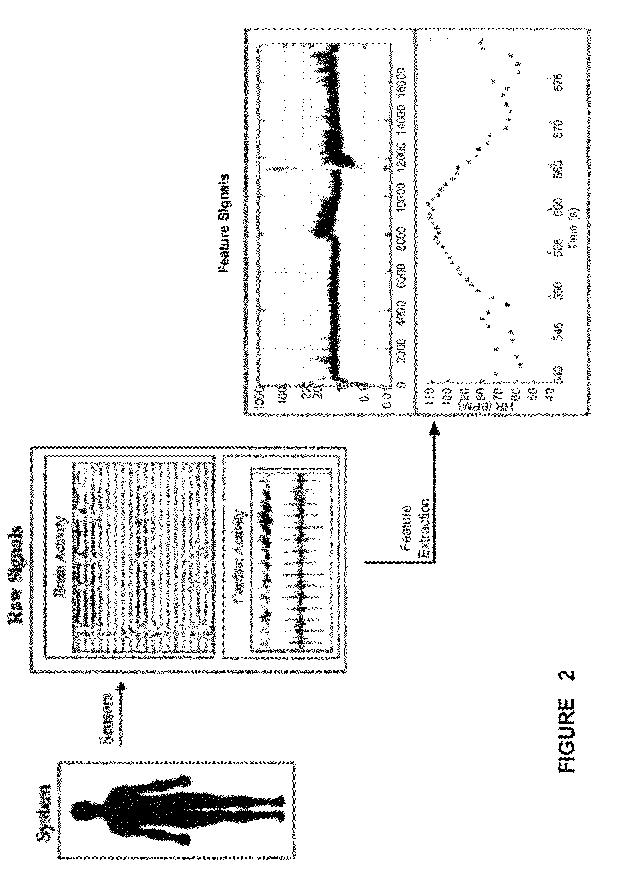 Detecting, assessing and managing epilepsy using a multi-variate, metric-based classification analysis