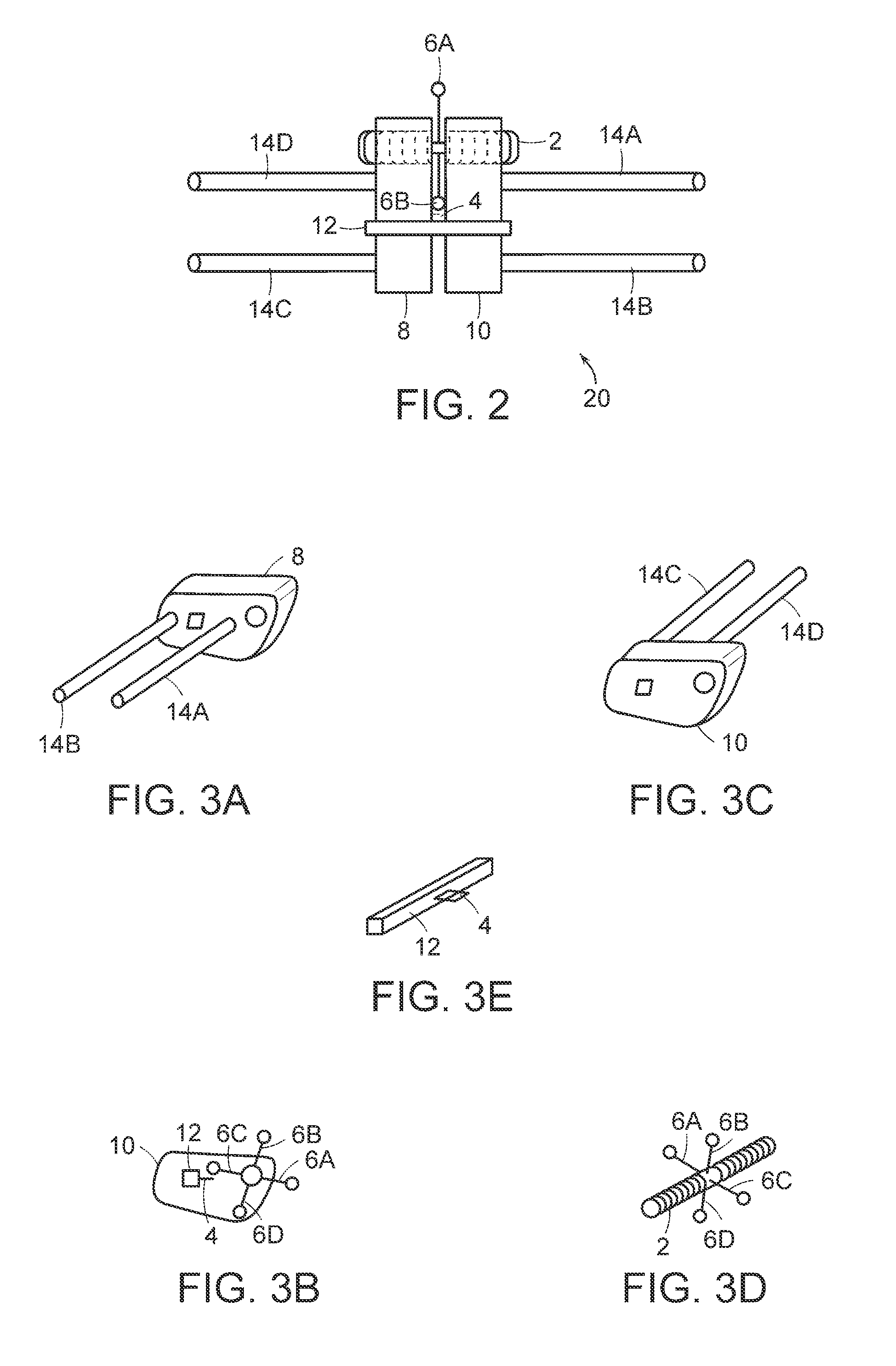 Palatal expansion device and methods