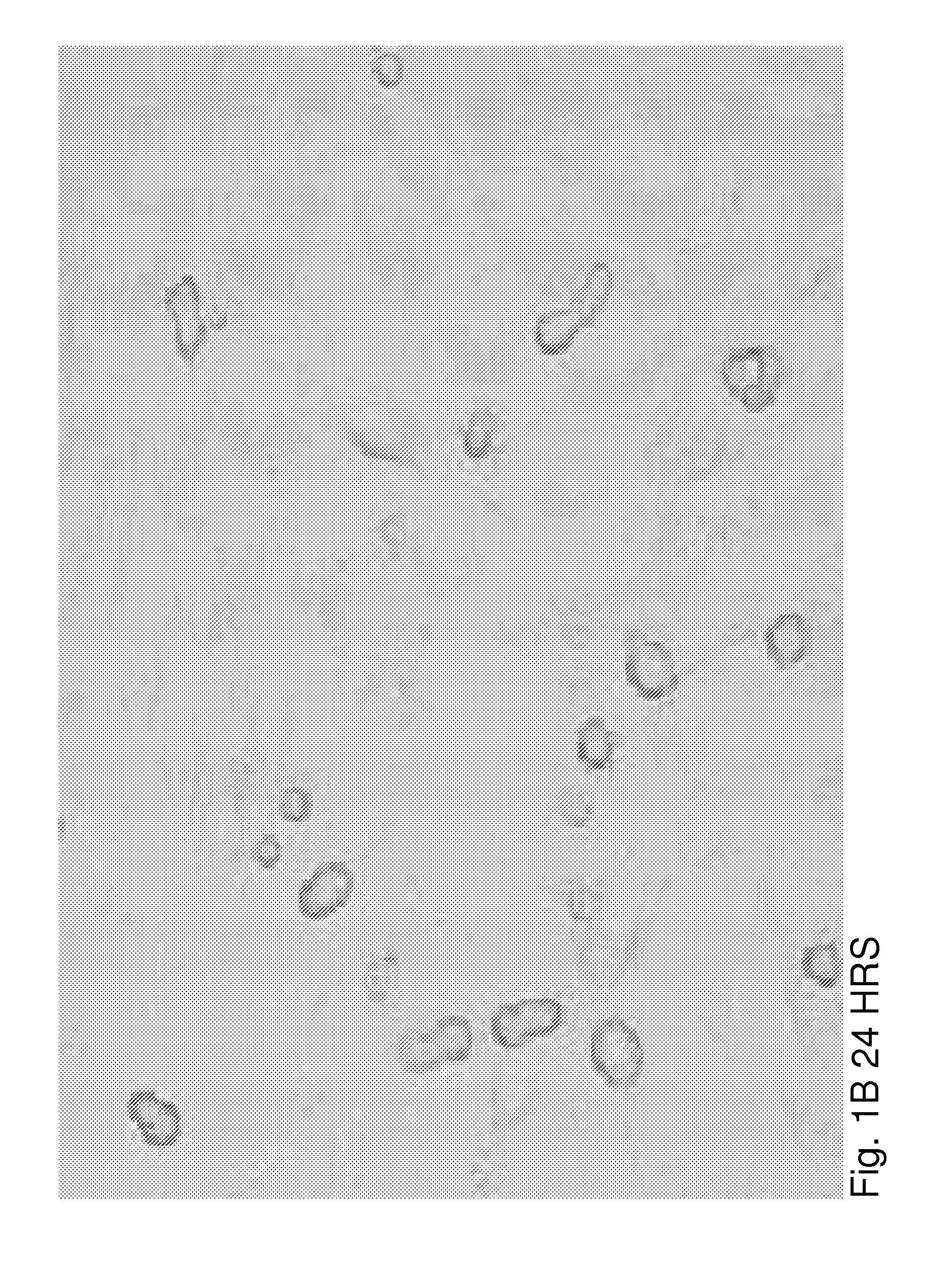 Method for inducing the formation of islet structures and improving beta cell function