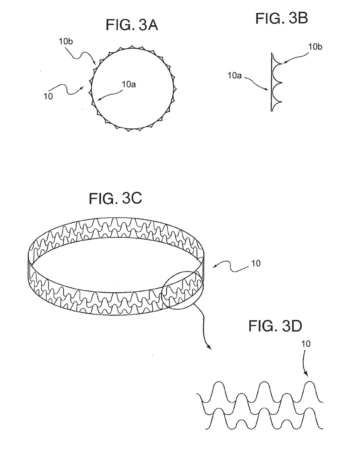 Endovascular implant