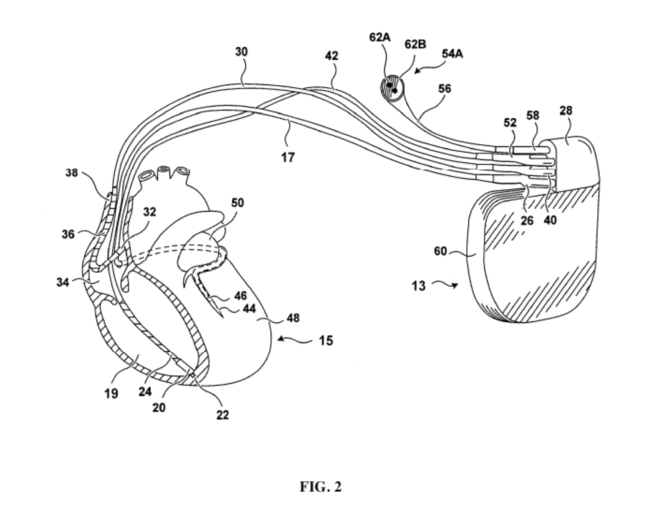 Method and device to monitor patients with kidney disease