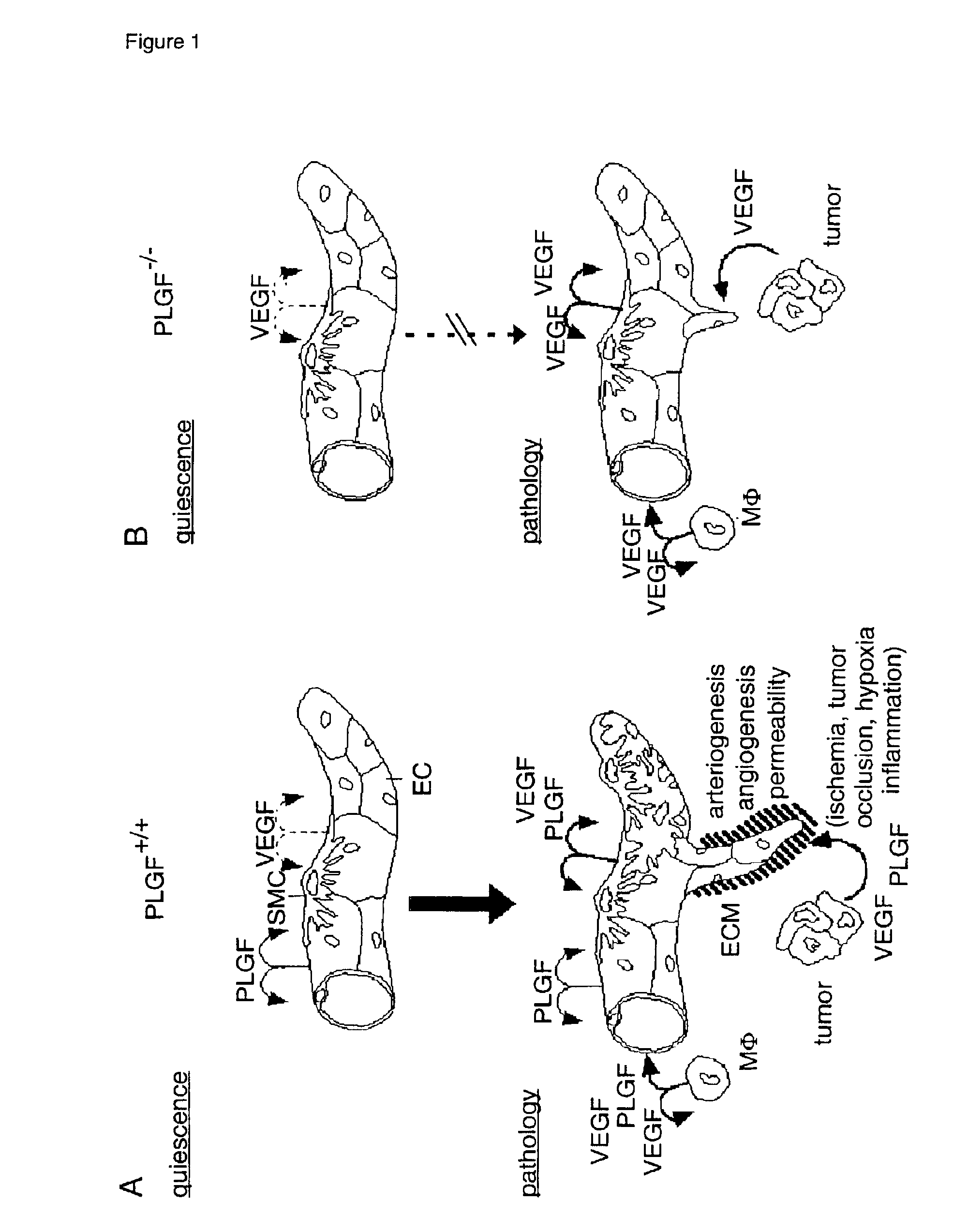 Inhibitors of placental growth factor for the treatment of pathological angiogenesis, pathological arteriogenesis, inflammation, tumor formation and/or vascular leakage