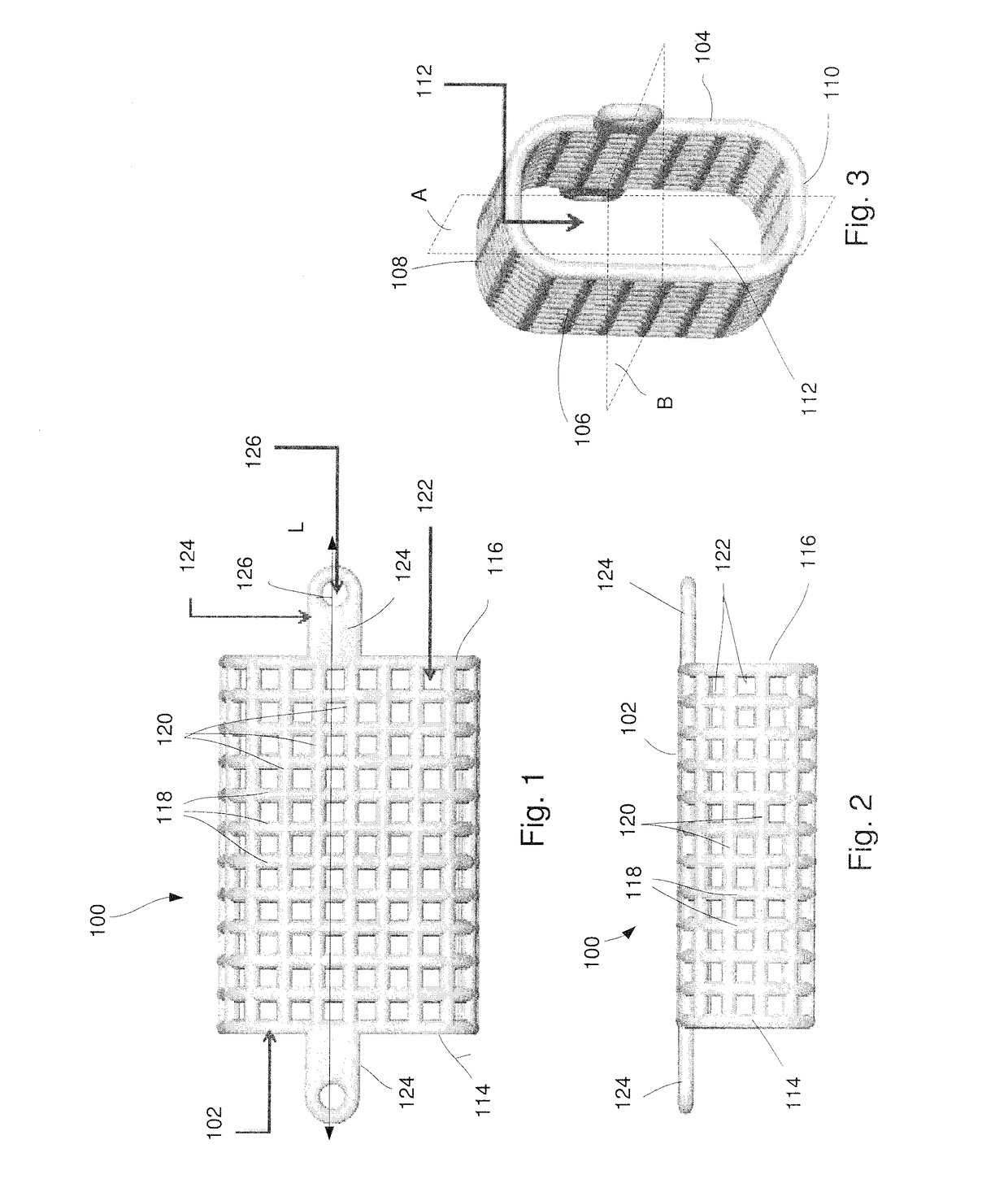 Patient-specific mandible graft cage