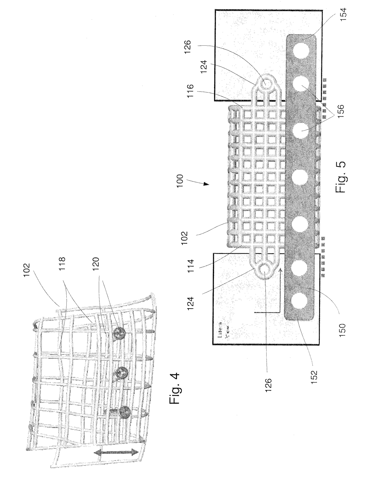 Patient-specific mandible graft cage