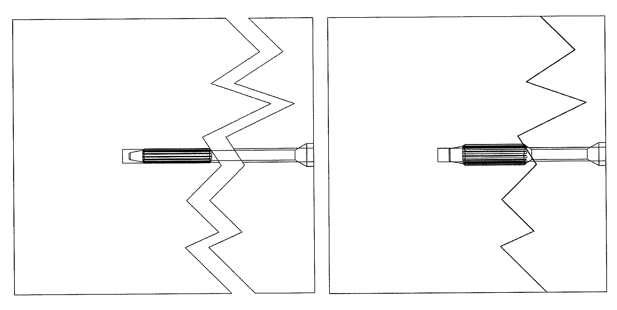 Medical device and its manufacture