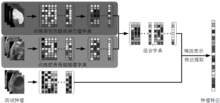 Identification method of primary central nervous system lymphoma and glioblastoma based on sparse representation system