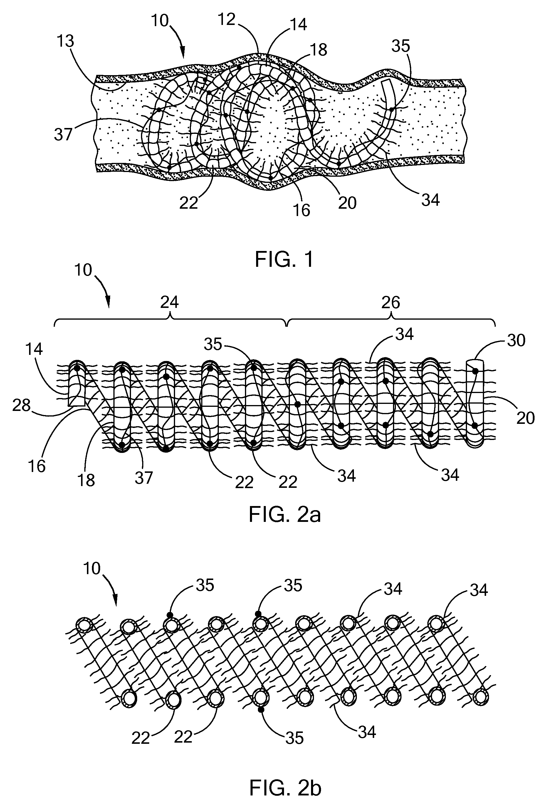 Spiral occluding device with an occlusion sail