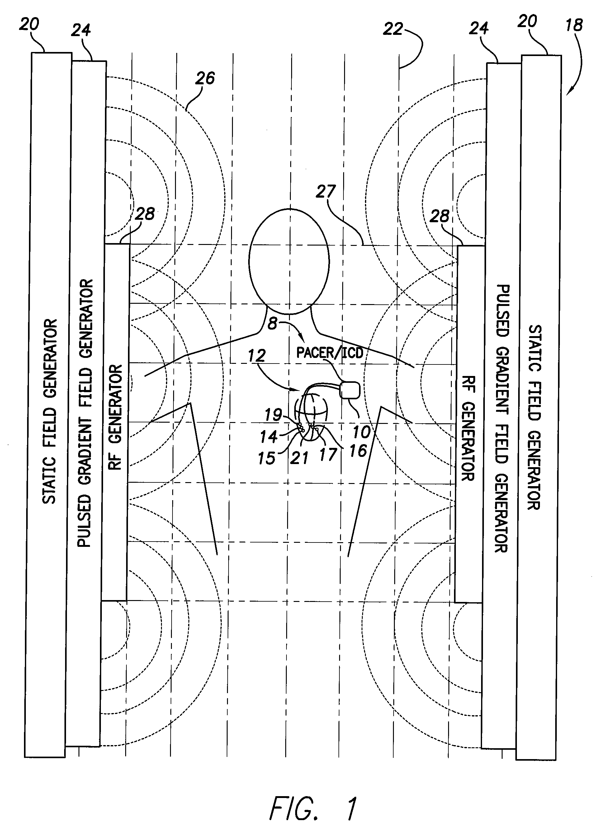 Systems and Methods for Disconnecting Electrodes of Leads of Implantable Medical Devices During an MRI to Reduce Lead Heating