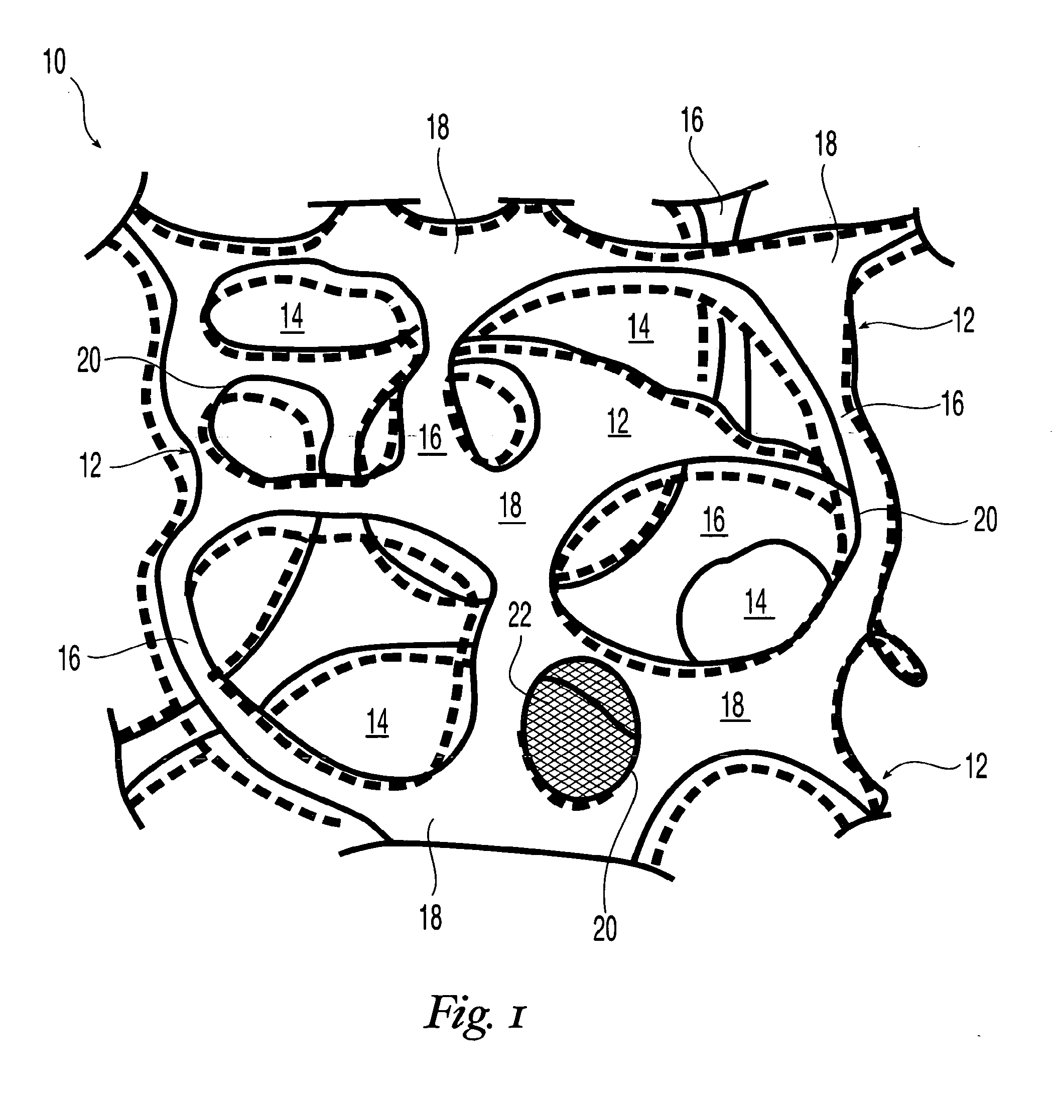 High performance reticulated elastomeric matrix preparation, properties, reinforcement, and use in surgical devices, tissue augmentation and/or tissue repair