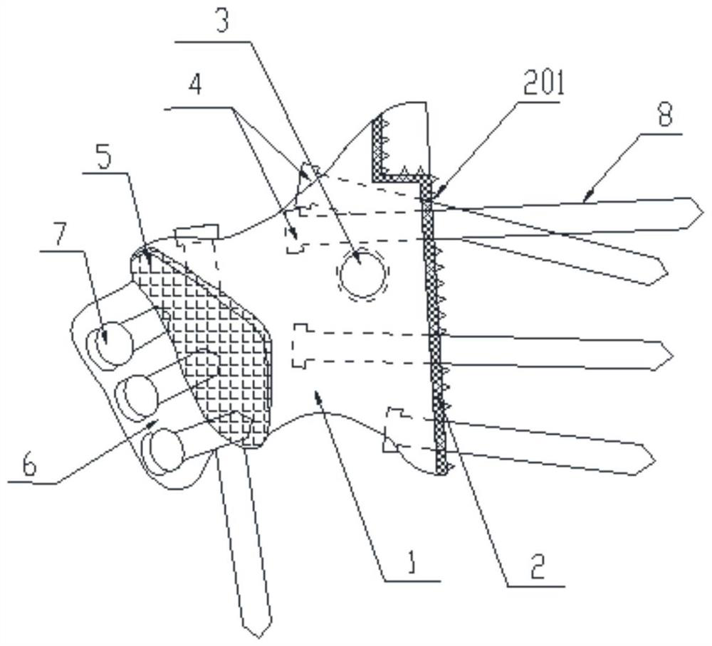 Pelvic prosthesis