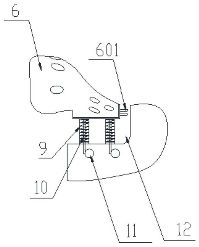 Pelvic prosthesis