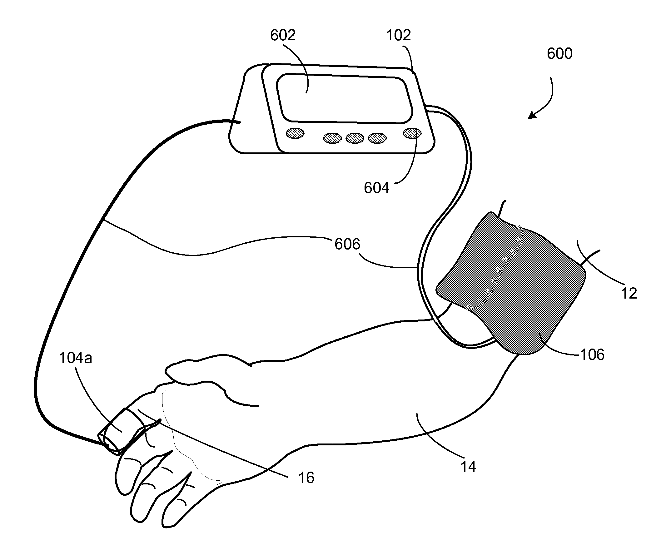 Method and apparatus for determining vascular health conditions