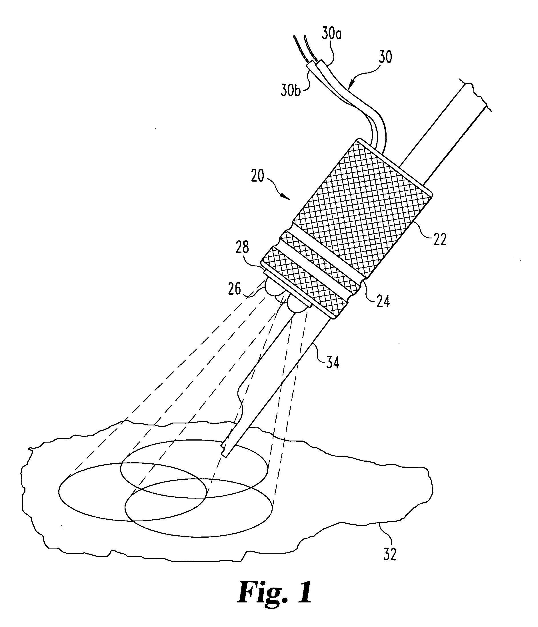 Lighted grip and alligator clip cord for tattoo machine